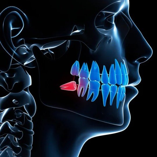 Imagem ilustrativa sobre dentição